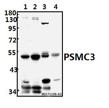 Western blot (WB) analysis of PSMC3 (V306) pAb at 1:500 dilution
Lane1:MCF-7 whole cell lysate(20ug)
Lane2:HEK293T whole cell lysate(20ug)
Lane3:The Uterus tissue lysate of Rat(20ug)
Lane4:The Kidney tissue lysate of Mouse(40ug)