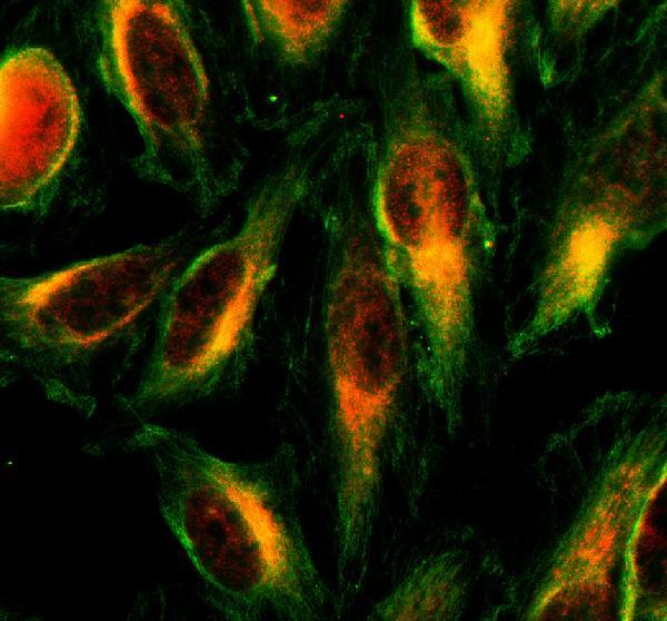 a07209 1 nudt16 primary antibodies if testing 1