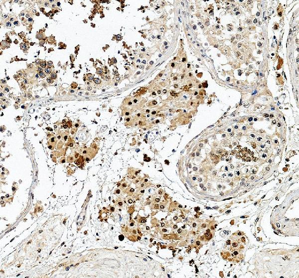 IHC analysis of NUDT16 using anti-NUDT16 antibody (A07209-1)