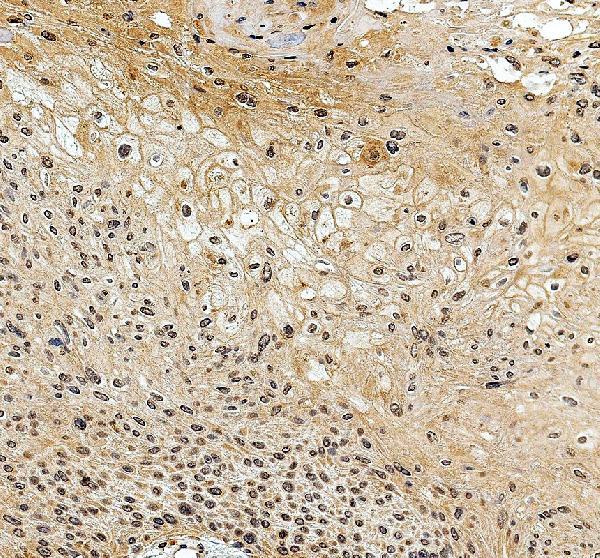 IHC analysis of NUDT16 using anti-NUDT16 antibody (A07209-1)