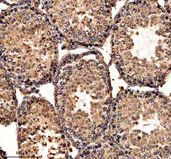 a07209 1 nudt16 primary antibodies ihc testing 3
