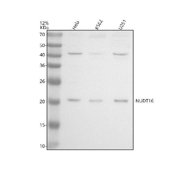 Western blot analysis of NUDT16 using anti-NUDT16 antibody (A07209-1)