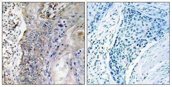 a07211 1 slc28a2 primary antibodies ihc testing 1