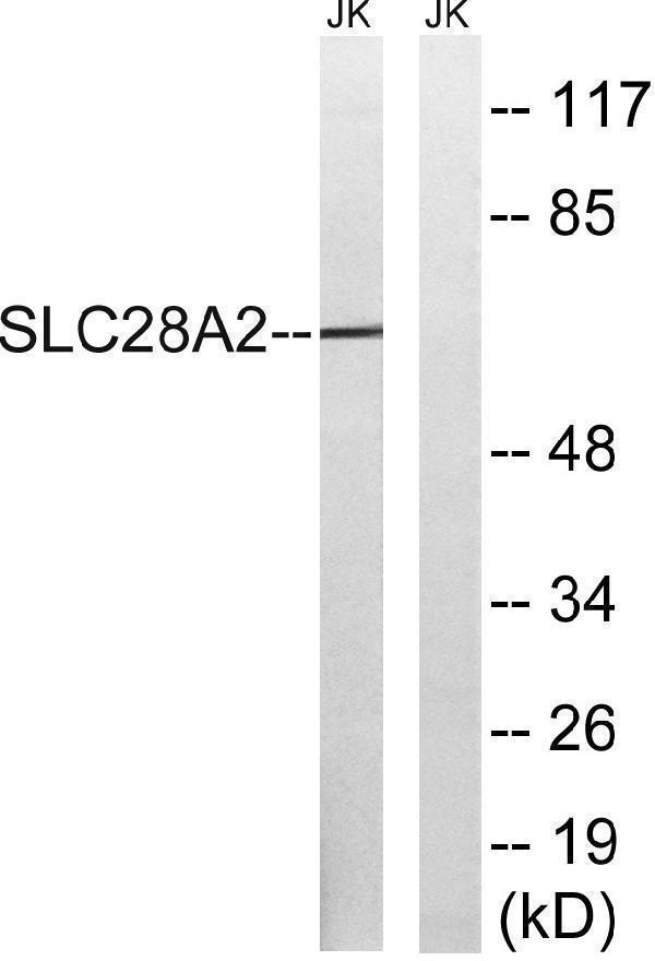 a07211 1 slc28a2 primary antibodies wb testing 4