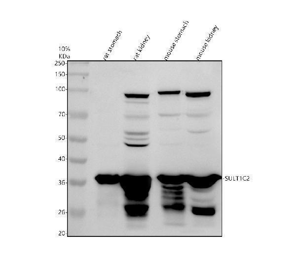 Western blot analysis of SULT1C2 using anti-SULT1C2 antibody (A07212-2)