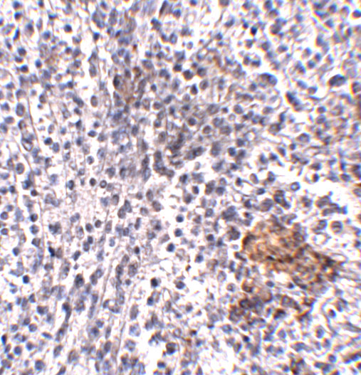 a07214 shoc2 primary antibodies ihc testing 2