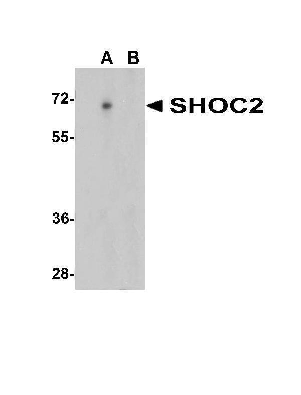 a07214 shoc2 primary antibodies wb testing 1