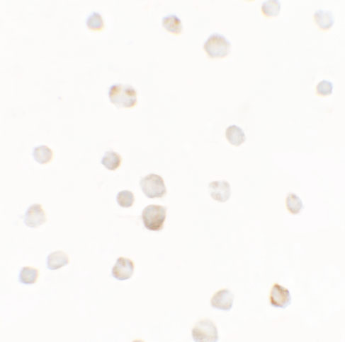 a07215 ttyh1 primary antibodies icc testing 2