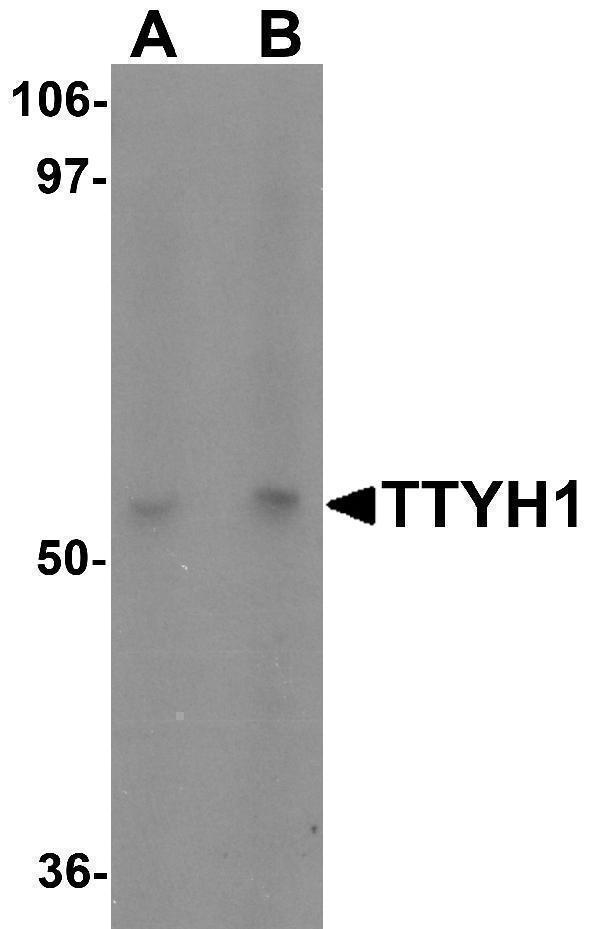a07215 ttyh1 primary antibodies wb testing 1