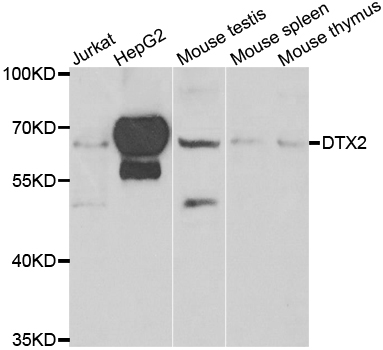 a07222 dtx2 primary antiboties wb testing 1