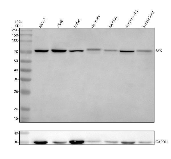 Western blot analysis of RYK using anti-RYK antibody (A07225-1)