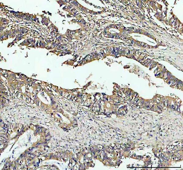 IHC analysis of PRKAR1B using anti-PRKAR1B antibody (A07227-2)