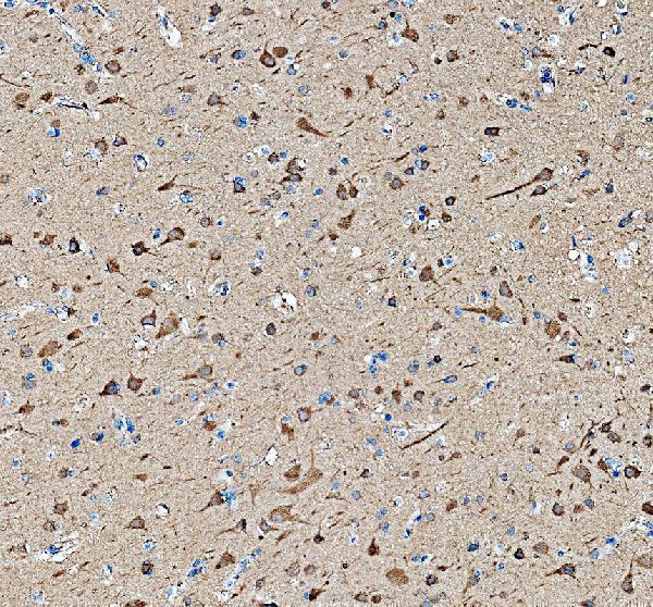 IHC analysis of PRKAR1B using anti-PRKAR1B antibody (A07227-2)