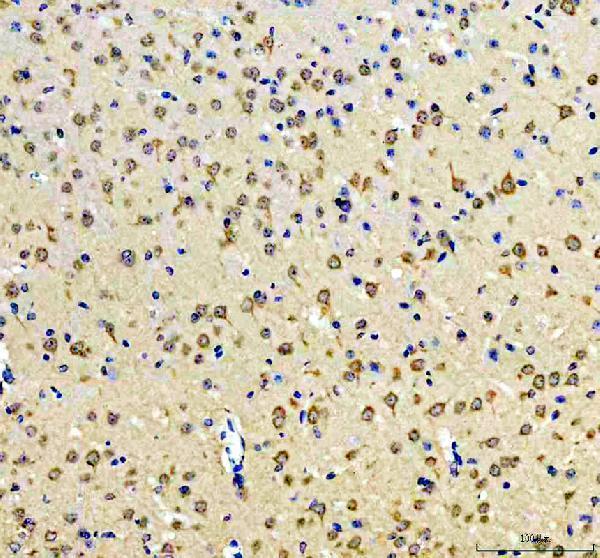 a07227 2 prkar1b primary antibodies ihc testing 3