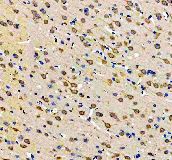 a07227 2 prkar1b primary antibodies ihc testing 4