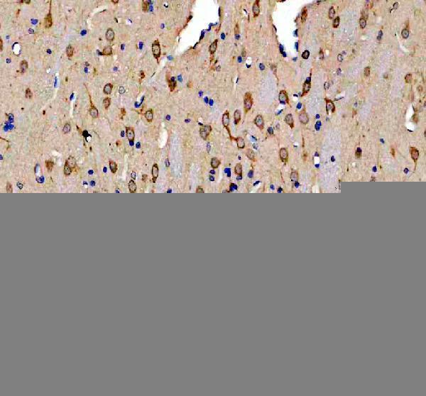 a07227 2 prkar1b primary antibodies ihc testing 5