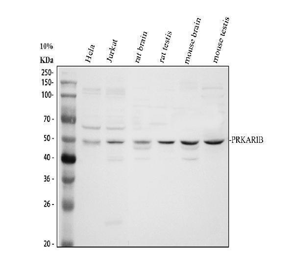Western blot analysis of PRKAR1B using anti-PRKAR1B antibody (A07227-2)