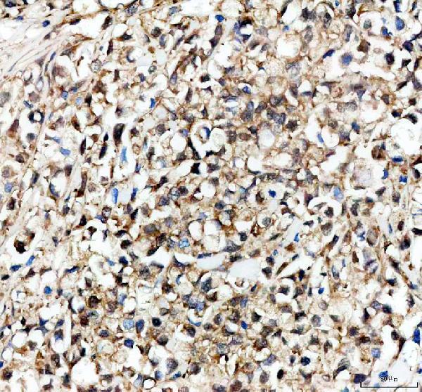 IHC analysis of EXOSC9 using anti-EXOSC9 antibody (A07231-3)