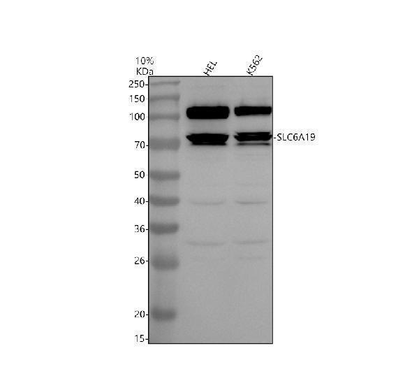 Western blot analysis of SLC6A19 using anti-SLC6A19 antibody (A07232-1)