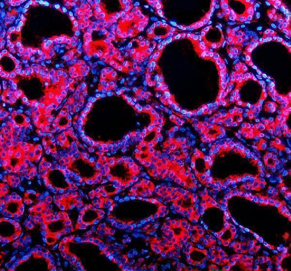 a07234 3 tmed10 primary antibodies if testing 1