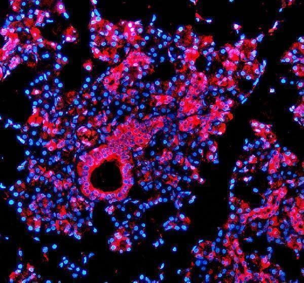 a07234 3 tmed10 primary antibodies if testing 2