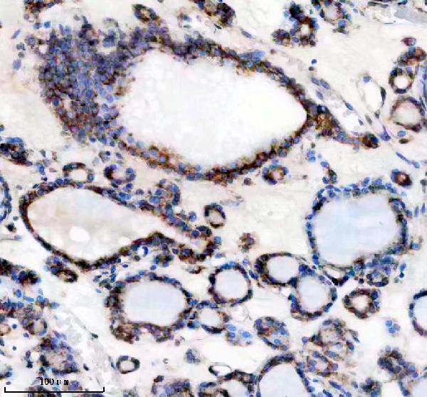 IHC analysis of TMP21/TMED10 using anti-TMP21/TMED10 antibody (A07234-3)