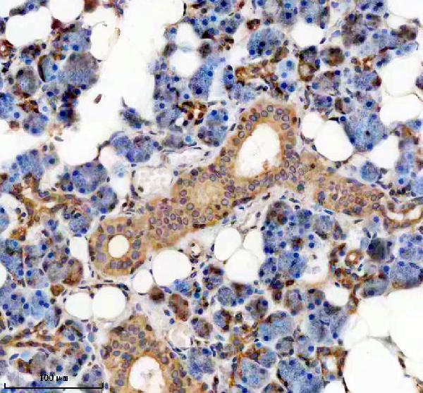 IHC analysis of TMP21/TMED10 using anti-TMP21/TMED10 antibody (A07234-3)