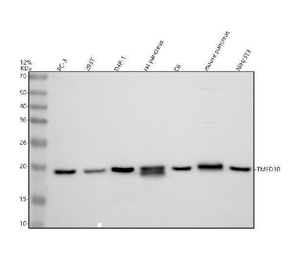 Western blot analysis of TMP21/TMED10 using anti-TMP21/TMED10 antibody (A07234-3)