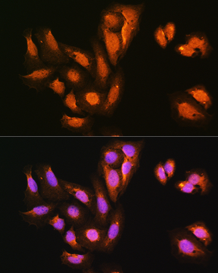 Immunofluorescence analysis of U2OS cells using KIFAP3 Rabbit pAb  at dilution of 1:100