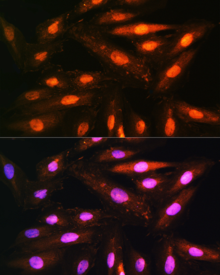 a07239 kifap3 primary antiboties if testing 4