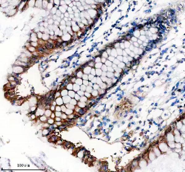 IHC analysis of TNS4 using anti-TNS4 antibody (A07240-1)