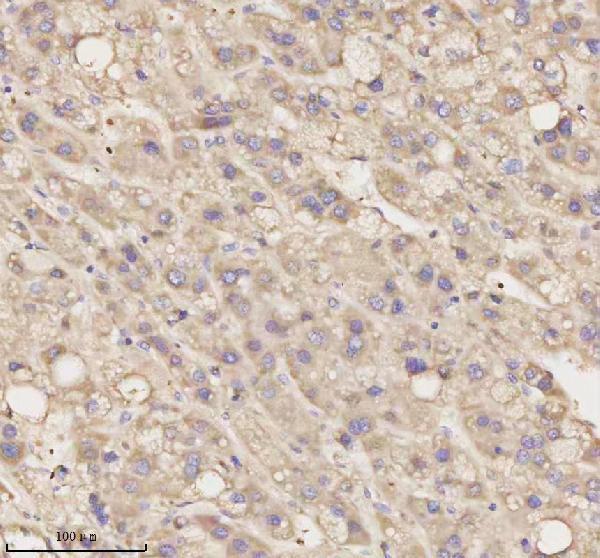  IHC analysis of MEST using anti-MEST antibody (A07241-1)