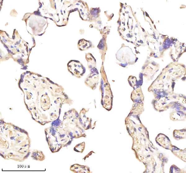  IHC analysis of MEST using anti-MEST antibody (A07241-1)