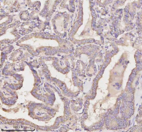 a07241 1 mest primary antibodies ihc testing 4