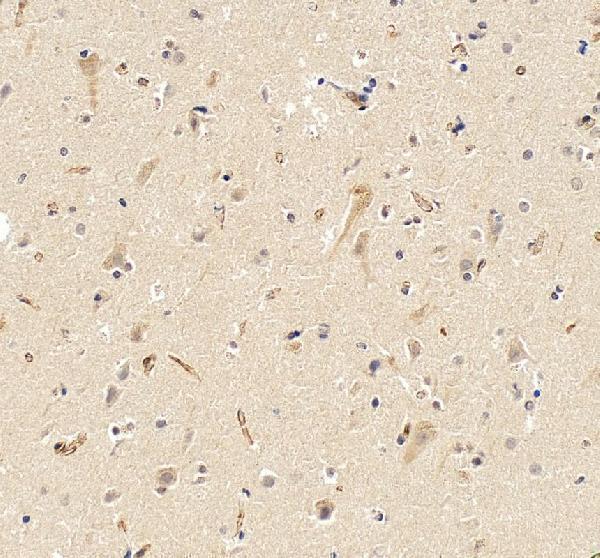 a07244 3 rab3gap2 primary antibodies ihc testing 6