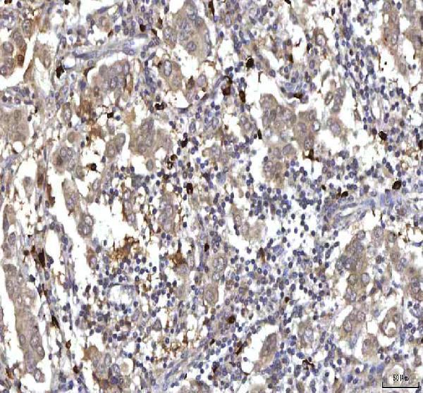  IHC analysis of RASGRP3 using anti-RASGRP3 antibody (A07245-1)