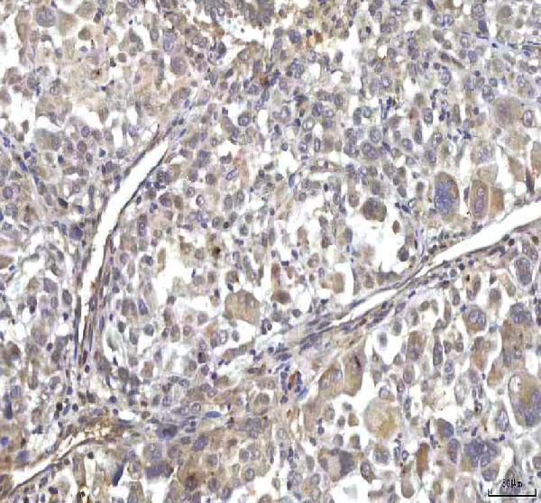  IHC analysis of RASGRP3 using anti-RASGRP3 antibody (A07245-1)