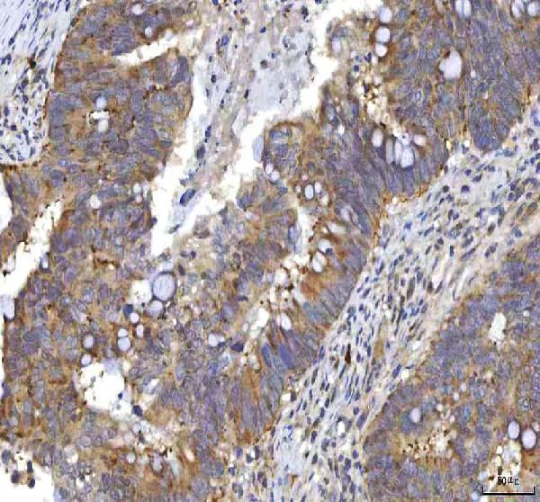  IHC analysis of RASGRP3 using anti-RASGRP3 antibody (A07245-1)