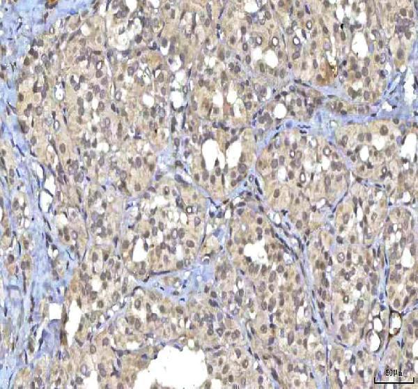 a07245 1 rasgrp3 primary antibodies ihc testing 4