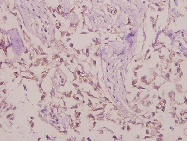 a07249 1 lypla1 primary antiboties ihc testing 2