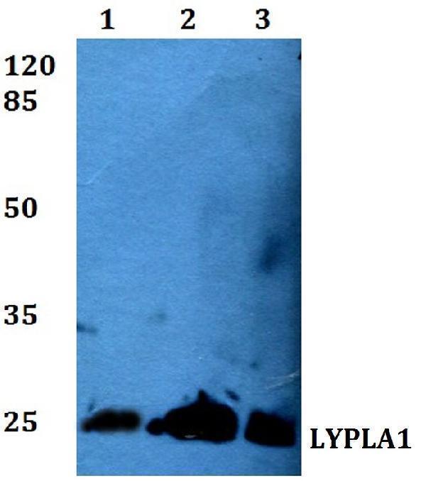 a07249 1 lypla1 primary antiboties wb testing 1