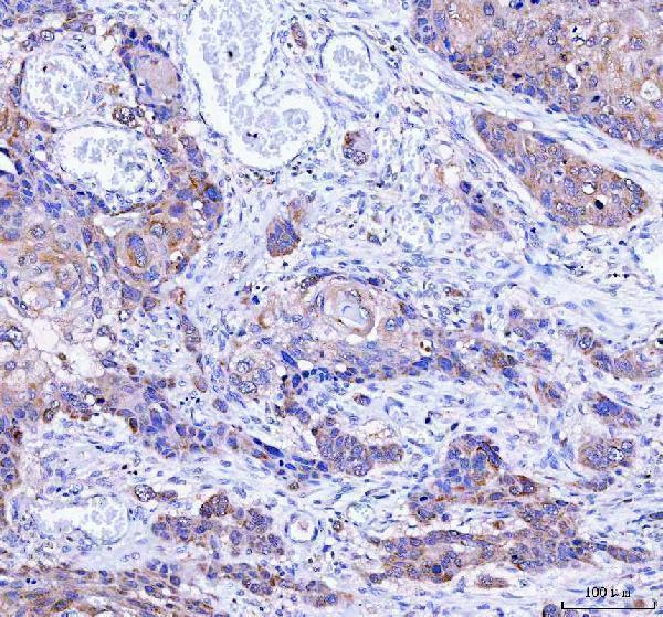  IHC analysis of LYPLA1 using anti-LYPLA1 antibody (A07249-2)