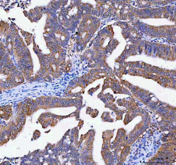  IHC analysis of LYPLA1 using anti-LYPLA1 antibody (A07249-2)