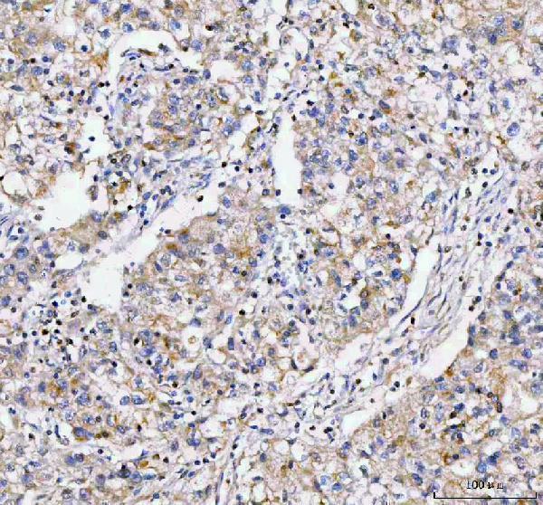a07249 2 lypla1 primary antibodies ihc testing 4