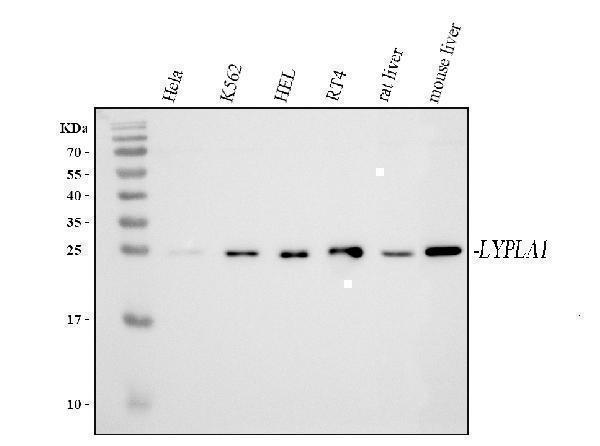  Western blot analysis of LYPLA1 using anti-LYPLA1 antibody (A16132-1)