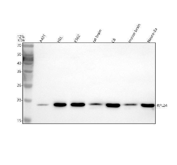  Western blot analysis of RPL24 using anti-RPL24 antibody (A07251-2)