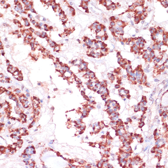 a07251 rpl24 primary antiboties ihc testing 2
