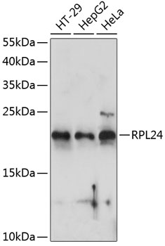 a07251 rpl24 primary antiboties wb testing 1