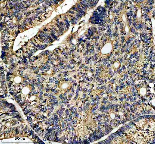 IHC analysis of IFT20 using anti-IFT20 antibody (A07253)