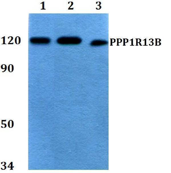 Western blot (WB) analysis of PPP1R13B polyclonal antibody at 1:500 dilution
Lane1:HEK293T whole cell lysate
Lane2:Raw264